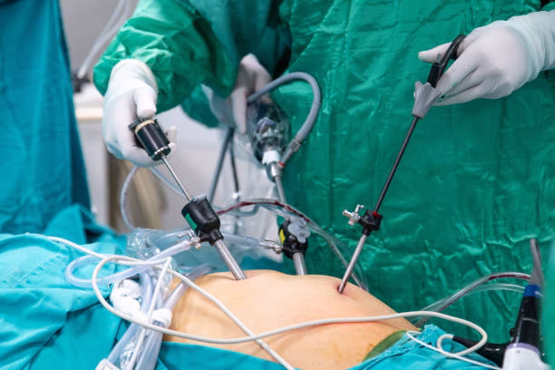 Laparoscopic Surgery
